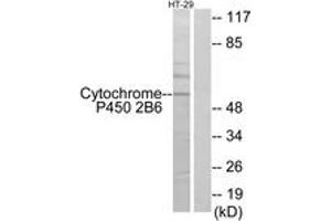 Western blot analysis of extracts from HT-29 cells, using Cytochrome P450 2B6 Antibody. (CYP2B6 antibody  (AA 241-290))