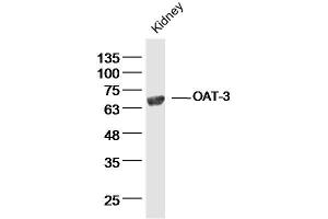 Mouse kidney lysates probed with OAT-3 Polyclonal Antibody, Unconjugated  at 1:300 dilution and 4˚C overnight incubation.