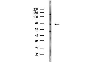 Western blot analysis of lysates from MCF7 cells(heat-shock,45 min treatment), using IL1RAPL1 Antibody at 1/1000 dilution.