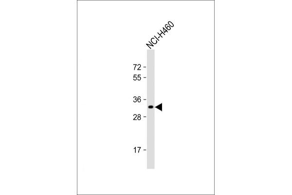 OR2B11 antibody  (C-Term)