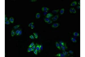 Immunofluorescent analysis of HepG2 cells using ABIN7173211 at dilution of 1:100 and Alexa Fluor 488-congugated AffiniPure Goat Anti-Rabbit IgG(H+L) (TMEM41A antibody  (AA 18-66))
