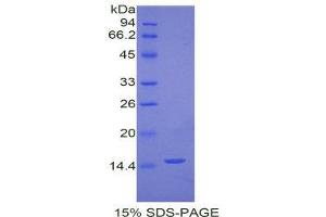 SDS-PAGE (SDS) image for Tryptase alpha/beta 1 (TPSAB1) (AA 151-275) protein (His tag) (ABIN1878356)