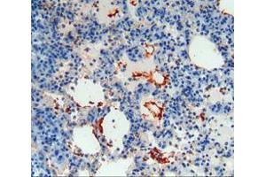 IHC-P analysis of lung tissue, with DAB staining.