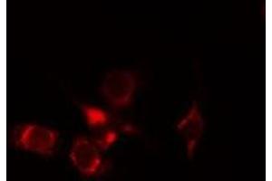 ABIN6275262 staining Hela cells by IF/ICC. (MYOM2 antibody  (Internal Region))