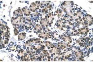 Immunohistochemical staining (Formalin-fixed paraffin-embedded sections) of human pancreas with DHX9 polyclonal antibody  at 4-8 ug/mL working concentration. (DHX9 antibody  (N-Term))