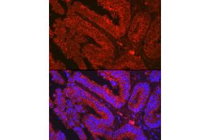 Immunofluorescence analysis of human colon carcinoma using OLFM4 Rabbit pAb (ABIN7269084) at dilution of 1:500 (40x lens). (Olfactomedin 4 antibody  (AA 211-510))