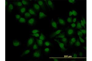 Immunofluorescence of monoclonal antibody to KIAA2002 on HeLa cell.