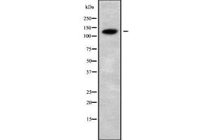 Western blot analysis of CATSPERB using COLO205 whole cell lysates (CATSPERB antibody  (C-Term))