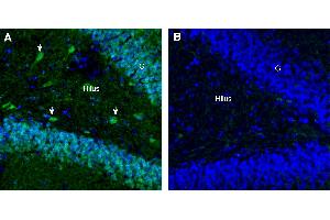anti-G Protein-Coupled Receptor 75 (GPR75) (AA 273-287), (Intracellular), (Loop 3) antibody