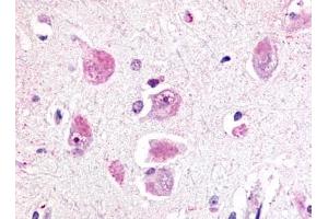 Immunohistochemical staining of Brain (Neurons and glia) using anti- RXFP3 antibody ABIN122238 (Relaxin 3 Receptor 1 antibody  (Cytoplasmic Domain))