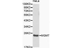 Western blot analysis of Hela cell lysate using MGMT antibody. (MGMT antibody  (AA 1-207))