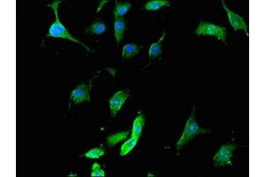 Immunofluorescent analysis of U251 cells using ABIN7168861 at dilution of 1:100 and Alexa Fluor 488-congugated AffiniPure Goat Anti-Rabbit IgG(H+L) (Septin 12 antibody  (AA 1-358))