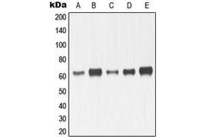 Western blot analysis of MMP14 expression in HeLa (A), HT1080 (B), MDMB23 (C), SP2/0 (D), mouse kidney (E), H9C2 (F) whole cell lysates. (MMP14 antibody  (C-Term))