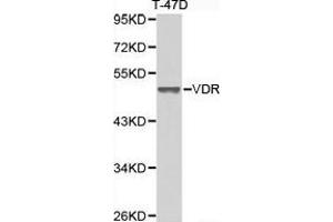 Western Blotting (WB) image for anti-Vitamin D Receptor (VDR) antibody (ABIN1875322) (Vitamin D Receptor antibody)