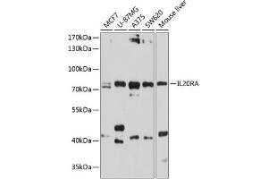Western blot analysis of extracts of various cell lines, using IL20RA antibody (ABIN6129281, ABIN6142355, ABIN6142356 and ABIN6214512) at 1:1000 dilution.