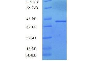 SDS-PAGE (SDS) image for Synuclein, alpha (SNCA) (AA 1-139), (partial) protein (GST tag) (ABIN1046507) (SNCA Protein (AA 1-139, partial) (GST tag))