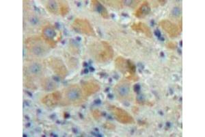 Immunohistochemistry (IHC) image for anti-Fibroblast Growth Factor 23 (FGF23) (AA 25-251) antibody (ABIN7432508)