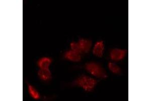 ABIN6277426 staining LoVo by IF/ICC. (PIBF1 antibody  (C-Term))