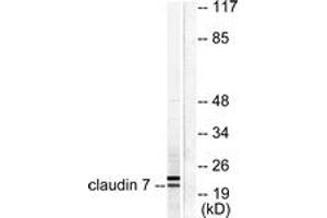 Western blot analysis of extracts from 293 cells, using Claudin 7 Antibody. (Claudin 7 antibody  (AA 162-211))