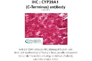 Image no. 1 for anti-Cytochrome P450, Family 39, Subfamily A, Polypeptide 1 (CYP39A1) antibody (ABIN1733458) (CYP39A1 antibody)