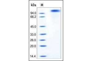 Mouse Her2, His Tag on SDS-PAGE under reducing (R) condition. (ErbB2/Her2 Protein (AA 23-653) (His tag))