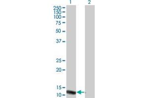Western Blot analysis of VPREB3 expression in transfected 293T cell line by VPREB3 monoclonal antibody (M08), clone 4H8. (VPREB3 antibody  (AA 24-123))