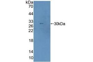 Detection of Recombinant AGA, Human using Polyclonal Antibody to Aspartylglucosaminidase (AGA) (AGA antibody  (AA 28-245))