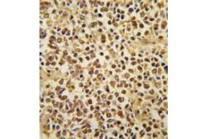 Image no. 3 for anti-SNAIL (SNAI1) (N-Term) antibody (ABIN357449) (SNAIL antibody  (N-Term))