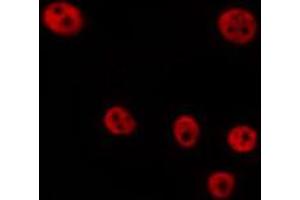 ABIN6268976 staining Hela by IF/ICC. (Cyclin D2 antibody  (pThr280))