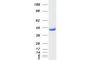 Western Blotting (WB) image for Fumarylacetoacetate Hydrolase (Fumarylacetoacetase) (FAH) protein (Myc-DYKDDDDK Tag) (ABIN2721458)