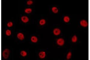 ABIN6266655 staining 293 by IF/ICC. (PIAS3 antibody  (N-Term))