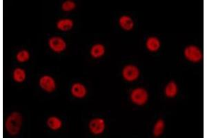 ABIN6266655 staining 293 by IF/ICC. (PIAS3 antibody  (N-Term))