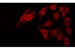 ABIN6269032 staining 293 by IF/ICC. (UCHL1 antibody  (C-Term))