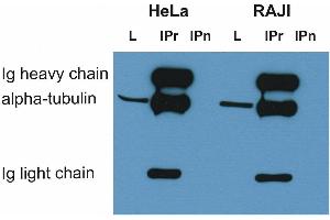 Immunoprecipitation of alpha-tubulin from HeLa and RAJI cell lysate by antibody TU-16 and its detection by antibody. (alpha Tubulin antibody)