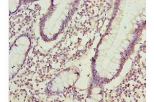Immunohistochemistry of paraffin-embedded human small intestine tissue using ABIN7143435 at dilution of 1:100 (ADPGK antibody  (AA 218-497))