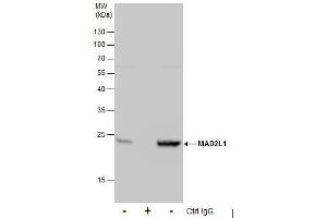 IP Image Immunoprecipitation of MAD2L1 protein from 293T whole cell extracts using 5 μg of MAD2L1 antibody [C2C3], C-term, Western blot analysis was performed using MAD2L1 antibody [C2C3], C-term, EasyBlot anti-Rabbit IgG  was used as a secondary reagent. (MAD2L1 antibody  (C-Term))