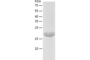Western Blotting (WB) image for Proteasome (Prosome, Macropain) Subunit, beta Type, 8 (Large Multifunctional Peptidase 7) (PSMB8) (AA 73-276) protein (His-IF2DI Tag) (ABIN7124630)