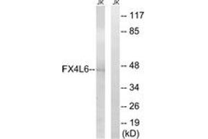 Western blot analysis of extracts from Jurkat cells, using FOXD4/L2/L3/L4/L5/L6 Antibody. (FOXD4/L2/L3/L4/L5/L6 antibody  (AA 281-330))