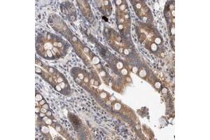 Immunohistochemical staining of human duodenum with MRPL37 polyclonal antibody  shows moderate cytoplasmic positivity in glandular cells.