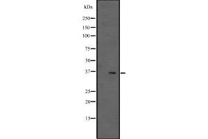 Western blot analysis of EBP2 expression in NCI-H292 cell line lysates ,The lane on the left is treated with the antigen-specific peptide. (EBNA1BP2 antibody  (Internal Region))