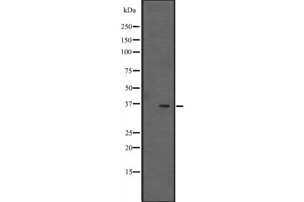 EBNA1BP2 antibody  (Internal Region)