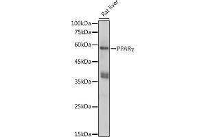 Western blot analysis of extracts of Rat liver, using PPARγ antibody (ABIN6134090, ABIN6146004, ABIN6146006 and ABIN6215096) at 1:1000 dilution. (PPARG antibody  (AA 70-170))