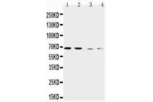 Anti-CAT1 antibody, Western blotting Lane 1: Human Placenta Tissue Lysate Lane 2: HELA Cell Lysate Lane 3: SKOV-3 Cell Lysate Lane 4:  Cell Lysate (SLC7A1 antibody  (C-Term))
