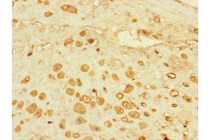 Immunohistochemistry of paraffin-embedded human placenta tissue using ABIN7143303 at dilution of 1:100 (Adenosine A2a Receptor antibody  (AA 291-412))