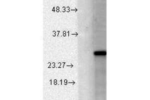 BK channel BETA2 Western Blot. (KCNMB2 antibody  (C-Term, N-Term))