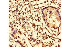 Immunohistochemistry of paraffin-embedded human appendix tissue using ABIN7148044 at dilution of 1:100 (Cofilin antibody  (AA 4-144))