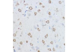 Immunohistochemistry of paraffin-embedded Mouse brain using CCT8 antibody (ABIN1679065, ABIN3018943, ABIN3018944 and ABIN6220637) at dilution of 1:100 (40x lens). (CCT8 antibody  (AA 248-497))