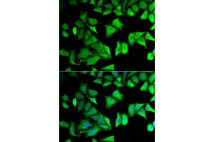 Immunofluorescence (IF) image for anti-Ribosomal Protein S12 (RPS12) antibody (ABIN1980257) (RPS12 antibody)