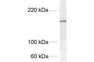 Western Blotting (WB) image for anti-GluN 2B (AA 42-60) antibody (ABIN1742497) (GluN 2B (AA 42-60) antibody)