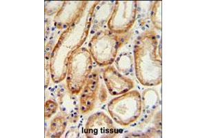 GALNT5 Antibody IHC analysis in formalin fixed and paraffin embedded human normal lung tissue followed by peroxidase conjugation of the secondary antibody and DAB staining. (GALNT5 antibody  (N-Term))